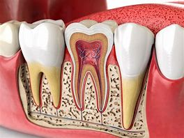 Root Canal Treatments